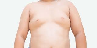 Preventing Gynecomastia