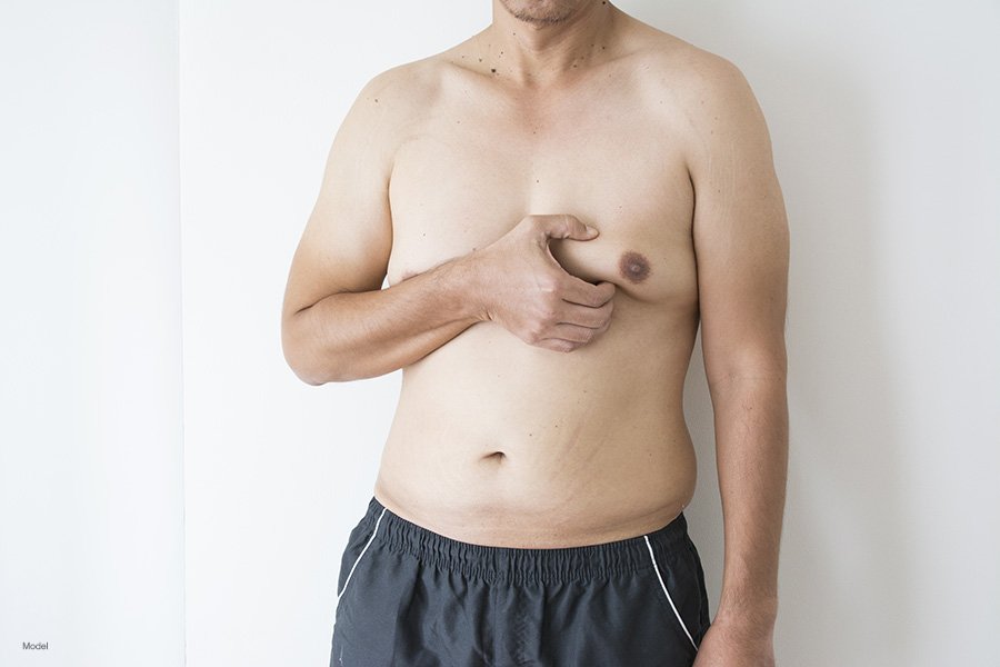 Preventing Gynecomastia